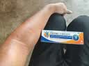 【原研进口】扶他林 双氯芬酸二乙胺乳胶剂 2%*50g 2盒装  缓解肌肉关节疼痛软组织扭伤拉伤挫伤骨关节炎 实拍图