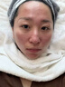 透真修复冻干粉精华液蓝铜胜肽多肽术晒后修护红血丝角质屏障敏肌泛红 实拍图
