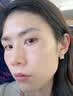 LA美国美白祛斑霜淡化黑色素去雀斑黄褐斑正品377男女士专用的老年 实拍图