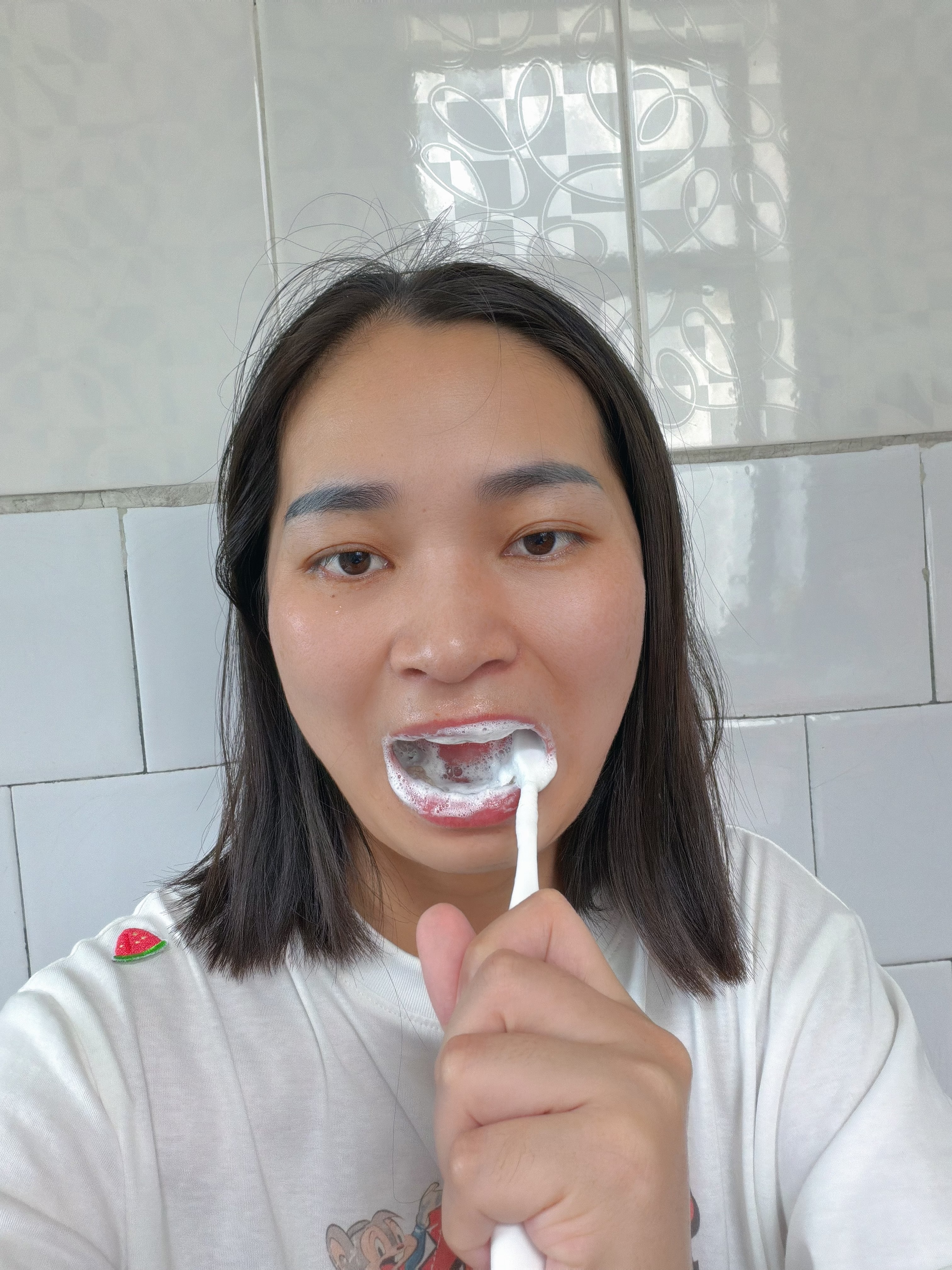 高施医用含氟牙膏状成人修复蛀牙补洞再生防蛀牙膏状蛀牙洞修复龋齿清理牙虫的药专用烂牙虫牙补牙正畸青少年高氟 实拍图