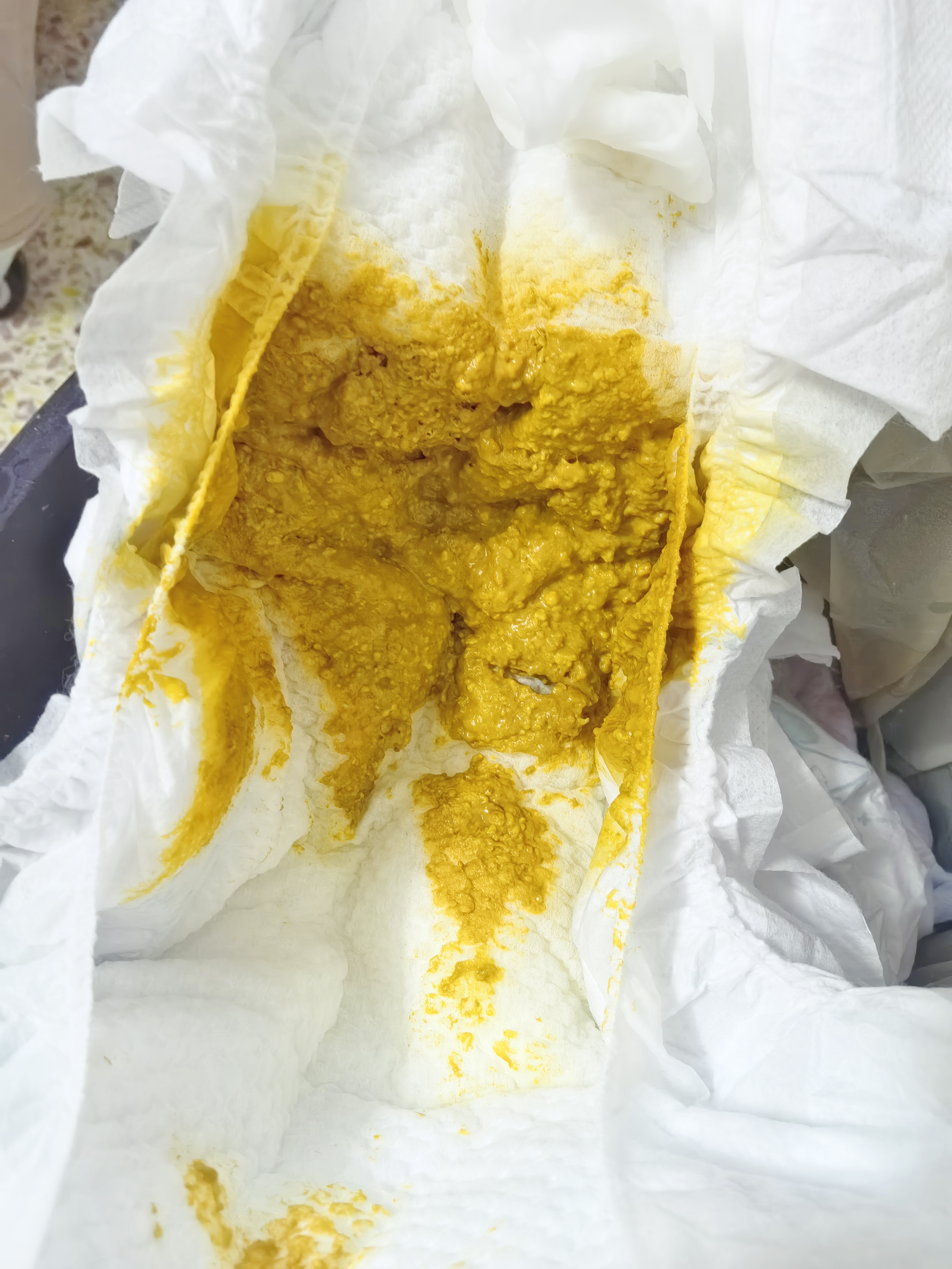 飞鹤迹萃1段顶量乳铁蛋白婴儿配方奶粉（0-6月）750g 8种HMOs 益生菌 实拍图