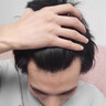 DELIISTON英国生姜防脱洗发水防脱发固发养发非增发密发育控油蓬松老姜王 【一瓶防脱、三瓶增加】买二赠一 正品有防伪 实拍图