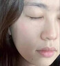 HEBST壬二酸凝胶15%浓度祛痘乳膏淡化祛痘印痘坑修复男士医美用60ml 实拍图