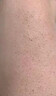 鸡皮肤疙瘩毛囊角化专用去除大腿胳膊手臂药膏身体乳霜毛周角化症 单盒装【鸡皮肤克星】 角质化增生专用的药磨砂膏去除神器 实拍图