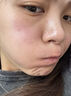 维特丝芦荟胶补水保湿晒后修复凝胶面霜祛痘印收缩毛孔烟酰胺男女士 实拍图