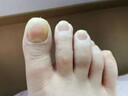 SOS德国SOS灰指甲笔原装进口指甲笔4ml/支旗舰正品改善灰指甲 【德国进口】指甲养护笔4ml2支 实拍图