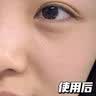 升级款悬磁波祛斑仪无创去红血丝阻断仪器祛斑点痣痘印疣痦980净丝仪红血丝阻断美容祛斑仪器 悬磁波祛斑+去红血丝+点痣疣 实拍图
