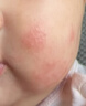 仁和炉甘石爽身露舒痱止痒膏湿热疹宝宝桃子水婴儿液体爽身粉舒缓保湿 实拍图