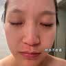 透真维生素b5修复精华液补水保湿术后皮肤屏障受损泛红角质层修护敏肌 实拍图