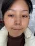 KOXY 科皙研黄芪水乳4件套装护肤品30-40-50岁女人去黄提亮补水抗皱紧致礼盒 实拍图