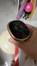 荣事达电动经络刷疏通按摩器揉腹仪全身通用多功能加热震动美容筋络神器腹背部手臂腿肩颈肚子按摩刷  豪华长续航【30档脉冲热敷震动+5精油】 实拍图