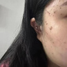 新稀宝辛富力锌硒宝片锌硒片男士备孕期妇女补锌海诺莱小红宝蛋白锌 实拍图