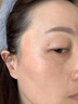 氨甲环酸乳膏祛斑非医用国药准字祛晒斑黄褐斑黑色素软膏祛斑霜 二盒【氨甲环酸乳膏祛斑医用国药准字】 实拍图