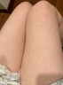 鸡皮肤疙瘩毛囊角化专用去除大腿胳膊手臂药膏身体乳霜毛周角化症 单盒装【鸡皮肤克星】 角质化增生专用的药磨砂膏去除神器 实拍图