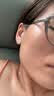 伊肤泉（EVE CHARM）医用次抛精华 透明质酸钠修复液 轻中度痤疮 2盒共60支七夕礼物 实拍图