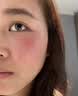 透真维生素b5修复精华液补水保湿术后皮肤屏障受损泛红角质层修护敏肌 实拍图