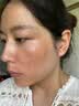 澳白汀（OHBT）氨甲环酸精华液传明酸湿敷原液医美祛斑改善暗沉黄褐斑专用50ml 实拍图