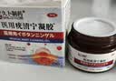 久卜制药扁平疣专用克疣去疣药膏神器丝状疣脖子小肉粒疣体脱落祛疣膏3盒 实拍图