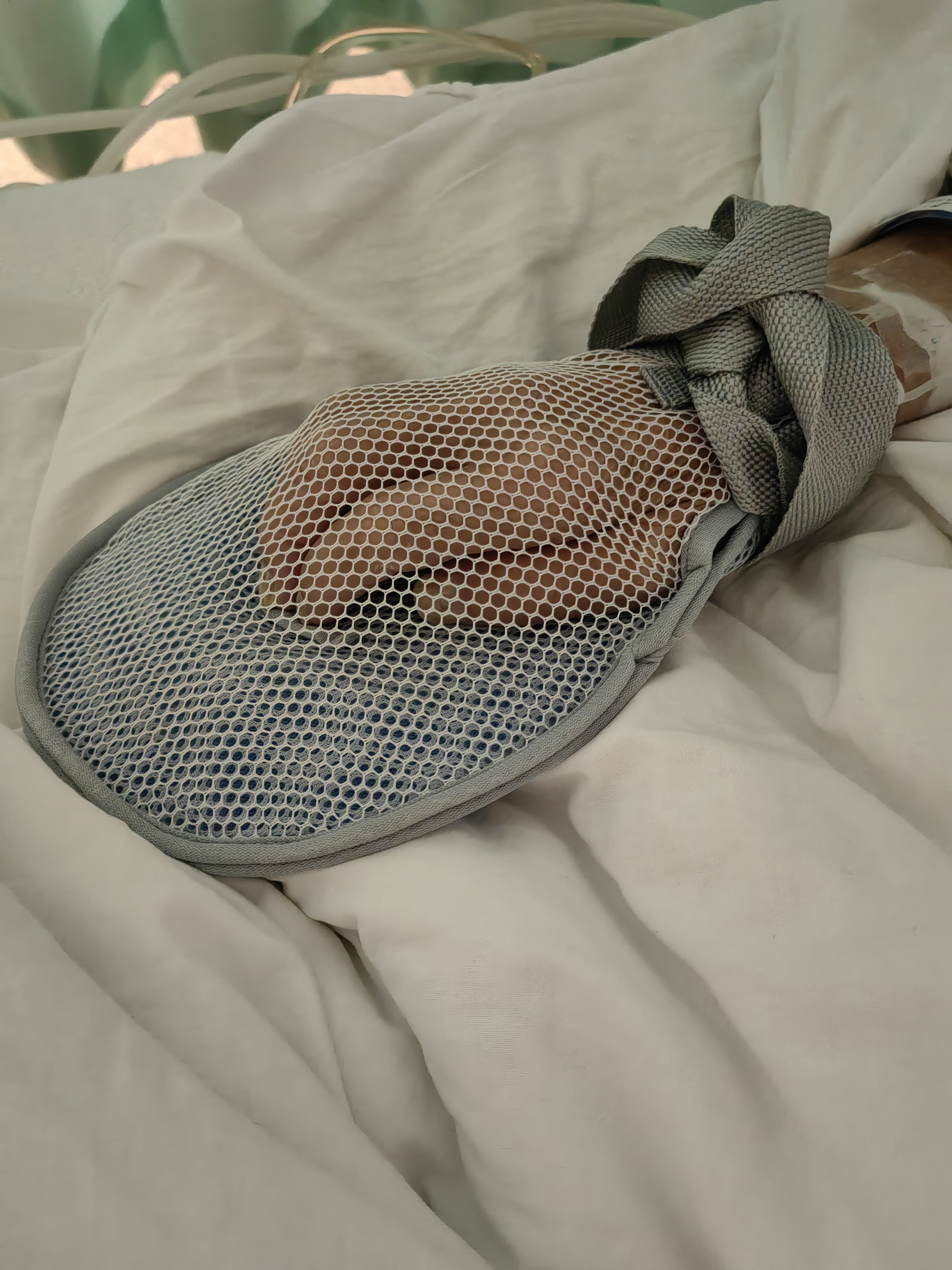 秝客防拔管约束手套老人防抓束缚手套手腕固定带绑绳防自伤 网眼款2只 实拍图