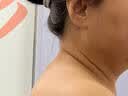 淞町制药淋巴结肿大消炎散结甲状腺专用消除脖子颈部乳腺结节增生搭膏药贴 实拍图