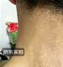 淞町制药牛皮藓膏银屑病消顽固皮炎湿疹皮癣真菌感染止痒抑菌皮肤专用非药 实拍图