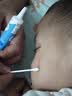 芭克kelocote官方硅凝胶巴克疤克祛疤膏治疗医用疤痕15g 实拍图