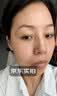川廿制药烟酰胺凝胶精华液祛斑美白淡化黑色素医用男女士专用搭熊果苷乳膏 实拍图