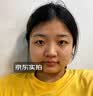 川廿制药熊果苷乳膏精华液去斑黑色素医用脸部改善暗沉男女士搭烟酰胺凝胶 实拍图