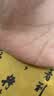 BKWILD去疤痕药膏祛疤修复凝胶医用硅酮除疤膏医院专用去疤膏手术缝针 实拍图