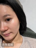 BKWILD美国进口硅酮去疤痕药膏祛疤膏疤痕修复除疤硅酮凝胶医用儿童 实拍图