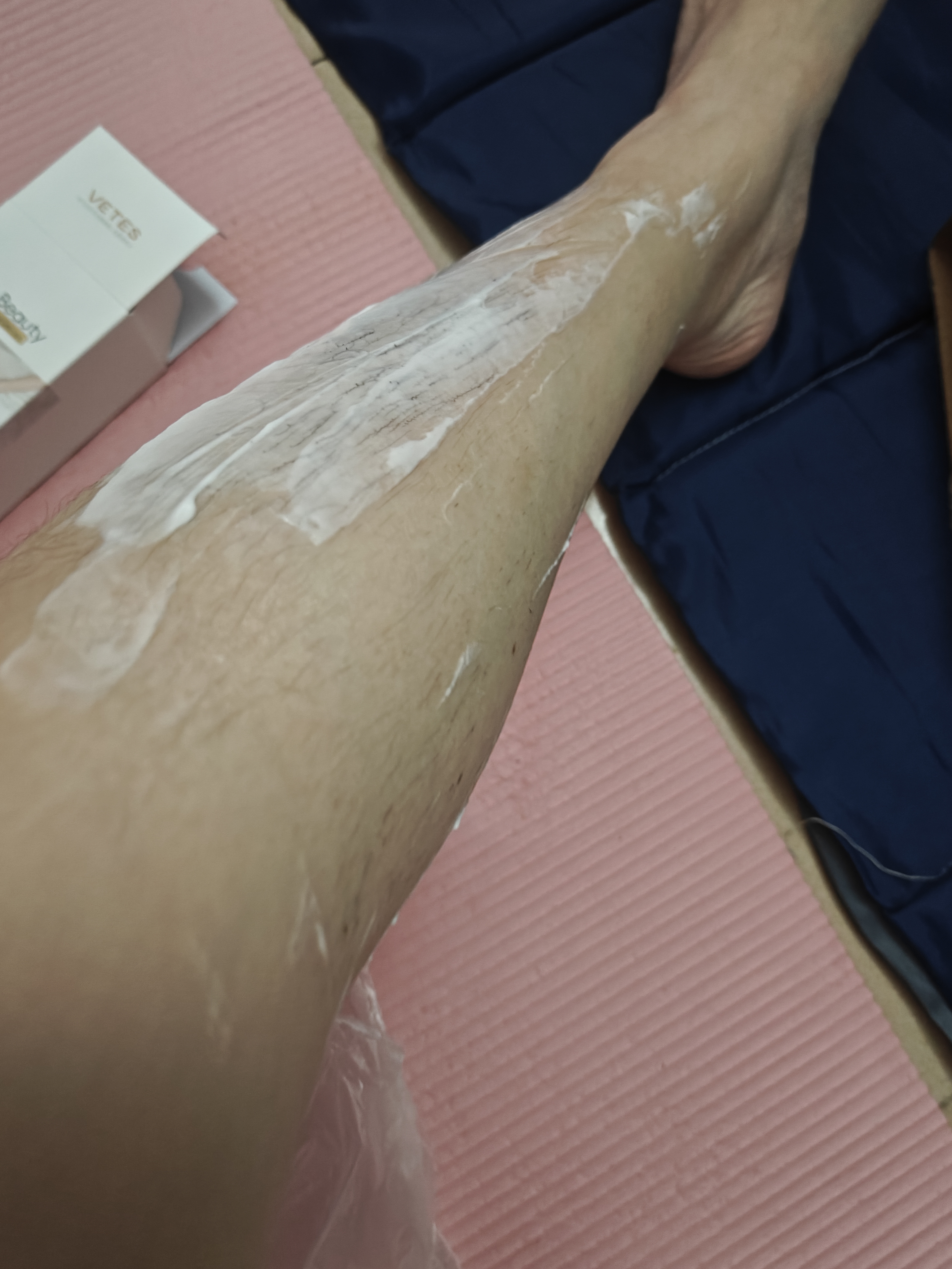 维特丝脱毛膏腋下私密处男女士专用全身温和去毛非永久去根不再生长医用 实拍图