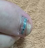 脚医生甲沟炎专用矫正器正甲贴纠正神器嵌甲脚趾甲矫正贴片1套 实拍图