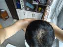 蔓迪【二代米诺地尔】蔓迪5%生发泡沫60g*2（敏皮专属 温和不油腻）男女士快速防脱育发米洛原液搽剂酊曼迪 实拍图