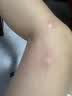 润本止痒滚珠冰露30ml紫草膏走珠舒缓止痒儿童消包红痒蚊虫叮咬便携 实拍图