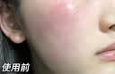 透真氨甲环酸5%精华液浓度美白祛医黄褐斑传明酸修护湿敷专用暗沉去黄 实拍图