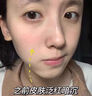 透真377祛斑爽肤水美白提亮补水保湿水抗皱紧致去黄改善暗沉护肤礼物 实拍图
