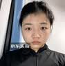 川廿制药熊果苷乳膏精华液去斑黑色素医用脸部改善暗沉男女士搭烟酰胺凝胶 实拍图