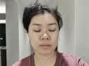 久卜制药烟酰胺i凝胶美白祛斑芦荟胶修复皮肤搭熊果苷淡化黑色素 1盒 实拍图