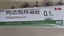 丽芙阿达帕林凝胶0.1%*35g第三代维a酸乳膏祛痘印改善毛孔粗大去黑头医用正品祛痘痤疮专用青少年修复药膏 实拍图
