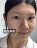 川廿制药去痣点痣膏无痕点斑点疣药水脸部不留疤美容院专用祛黑痣肉痣 实拍图