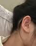 高坂制药滴耳液中耳炎止痒杀菌消炎真菌感染耳道特效清洗耳鸣胀发流脓3盒 实拍图