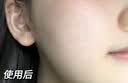 透真氨甲环酸5%精华液浓度美白祛医黄褐斑传明酸修护湿敷专用暗沉去黄 实拍图