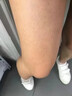 鸡皮肤疙瘩毛囊角化专用去除大腿胳膊手臂药膏身体乳霜毛周角化症 单盒装【鸡皮肤克星】 角质化增生专用的药磨砂膏去除神器 实拍图