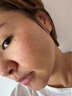 澳白汀（OHBT）氨甲环酸精华液传明酸湿敷原液医美祛斑改善暗沉黄褐斑专用50ml 实拍图