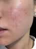 维特丝芦荟胶补水保湿晒后修复凝胶面霜祛痘印收缩毛孔烟酰胺男女士 实拍图