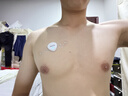 鱼跃（yuwell）心电监测仪穿戴式动态心电记录仪24小时可持续监测心脏次抛型H02 实拍图