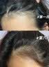 蔓迪生发喷雾米诺地尔酊90ml瓶5%浓度男女性防脱育发液药洗发水发际线生长快速生发增发凝胶搽剂曼迪 实拍图