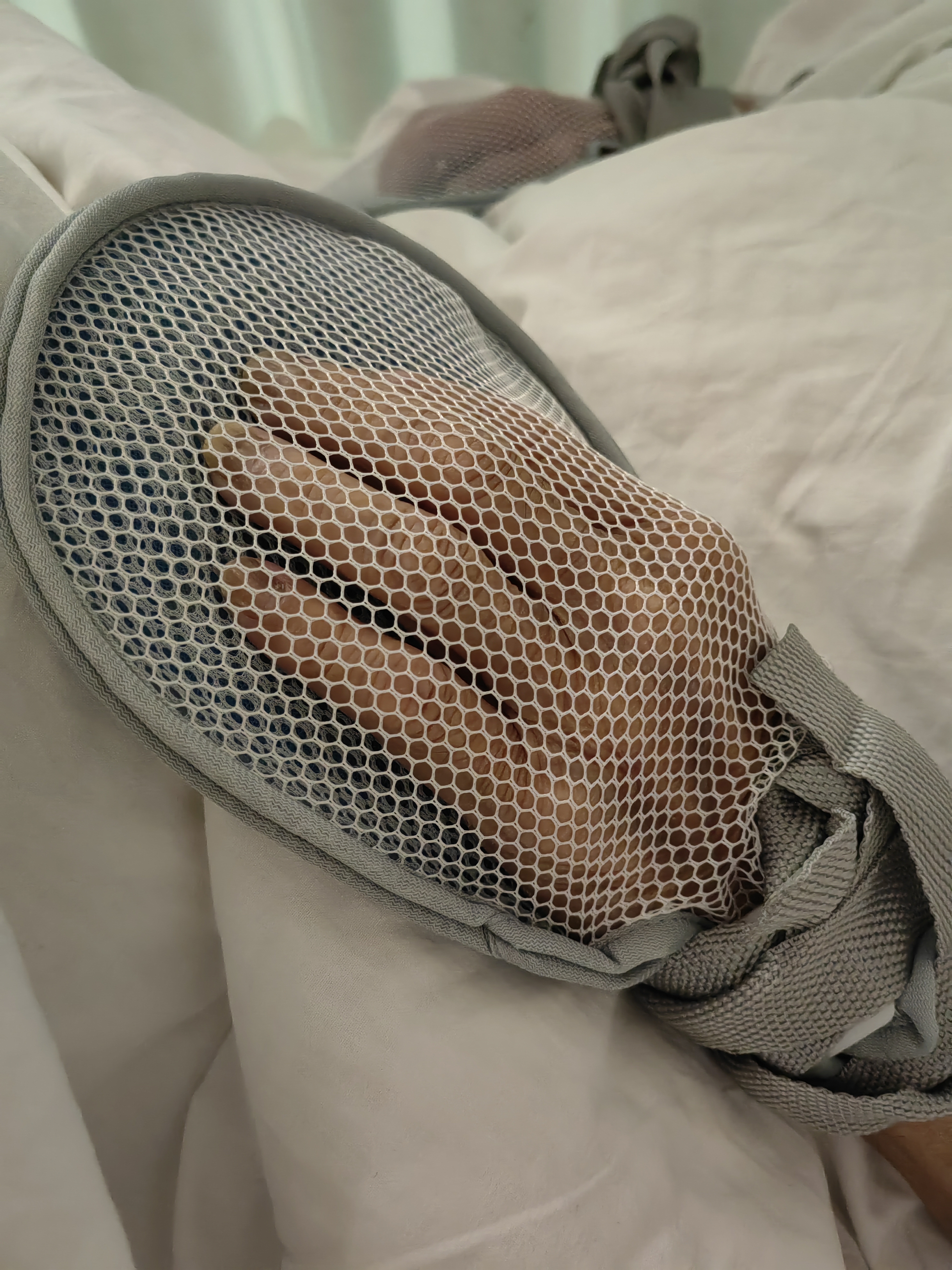 秝客防拔管约束手套老人防抓束缚手套手腕固定带绑绳防自伤 网眼款2只 实拍图