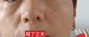 透真氨甲环酸精华液美白医黄褐祛斑传明酸次抛淡斑5%浓度专用湿敷液 实拍图