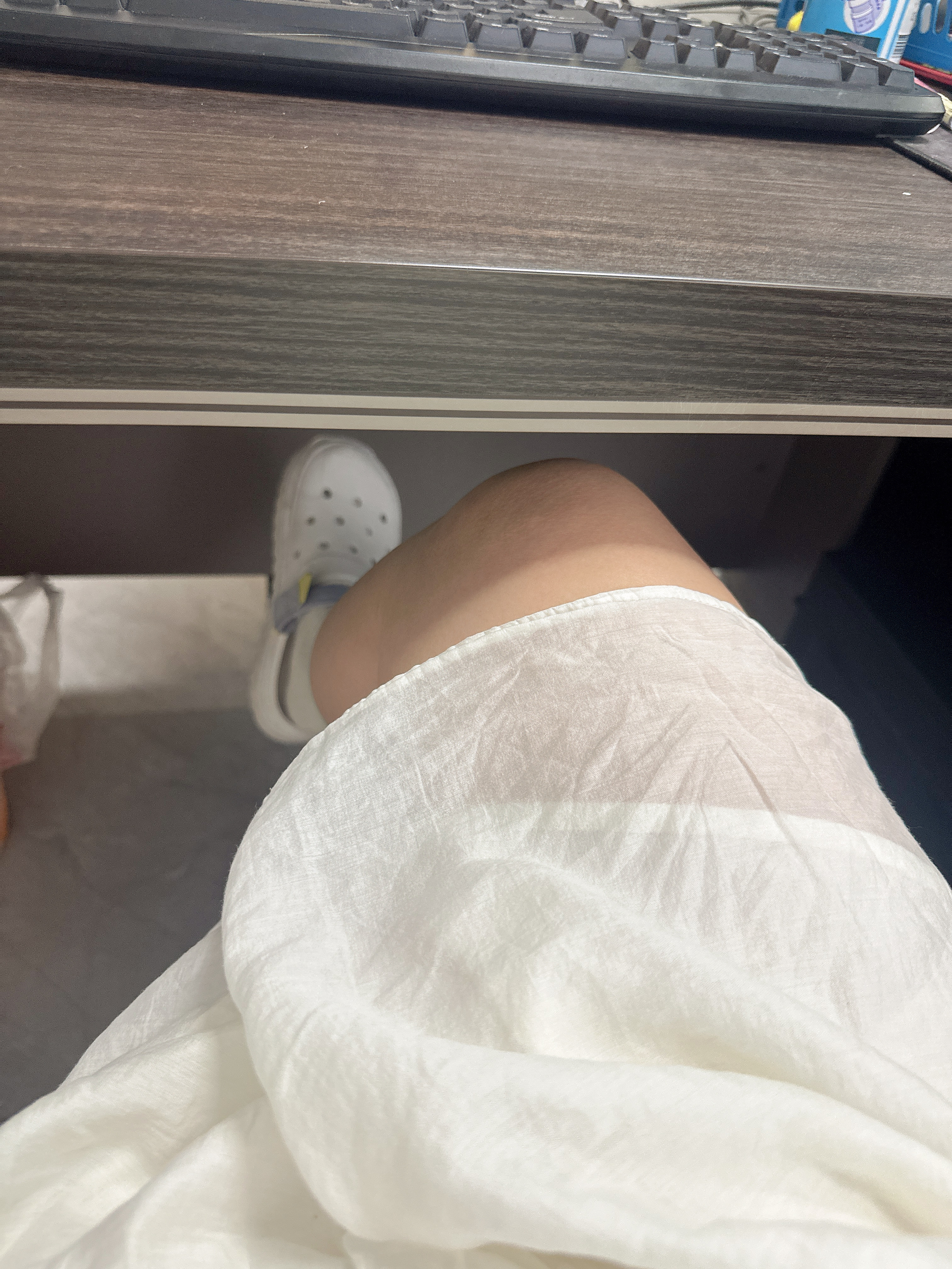 斯凯奇（Skechers）女鞋夏季厚底怪兽泡泡鞋透气软底防滑耐磨洞洞鞋 实拍图